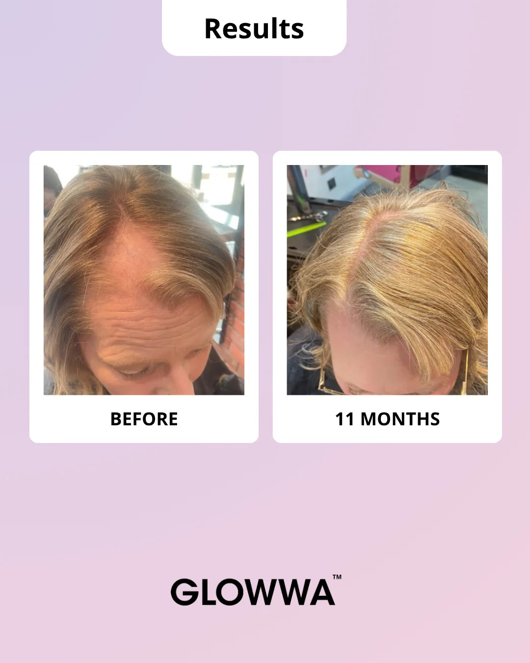 Glowwa Hair Food - Menopause