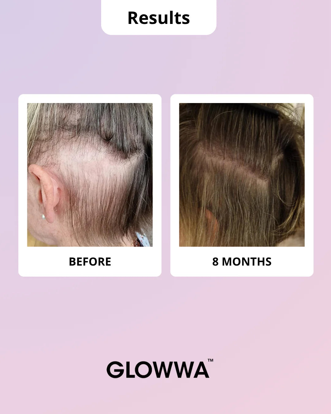 Glowwa Hair Food - Menopause